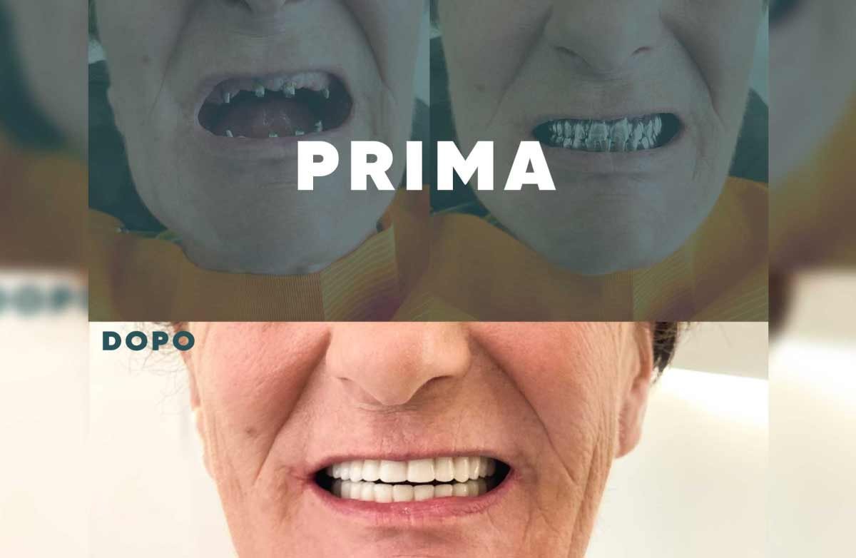 Prima e Dopo 3