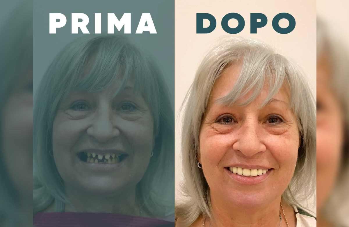 Prima e Dopo 4